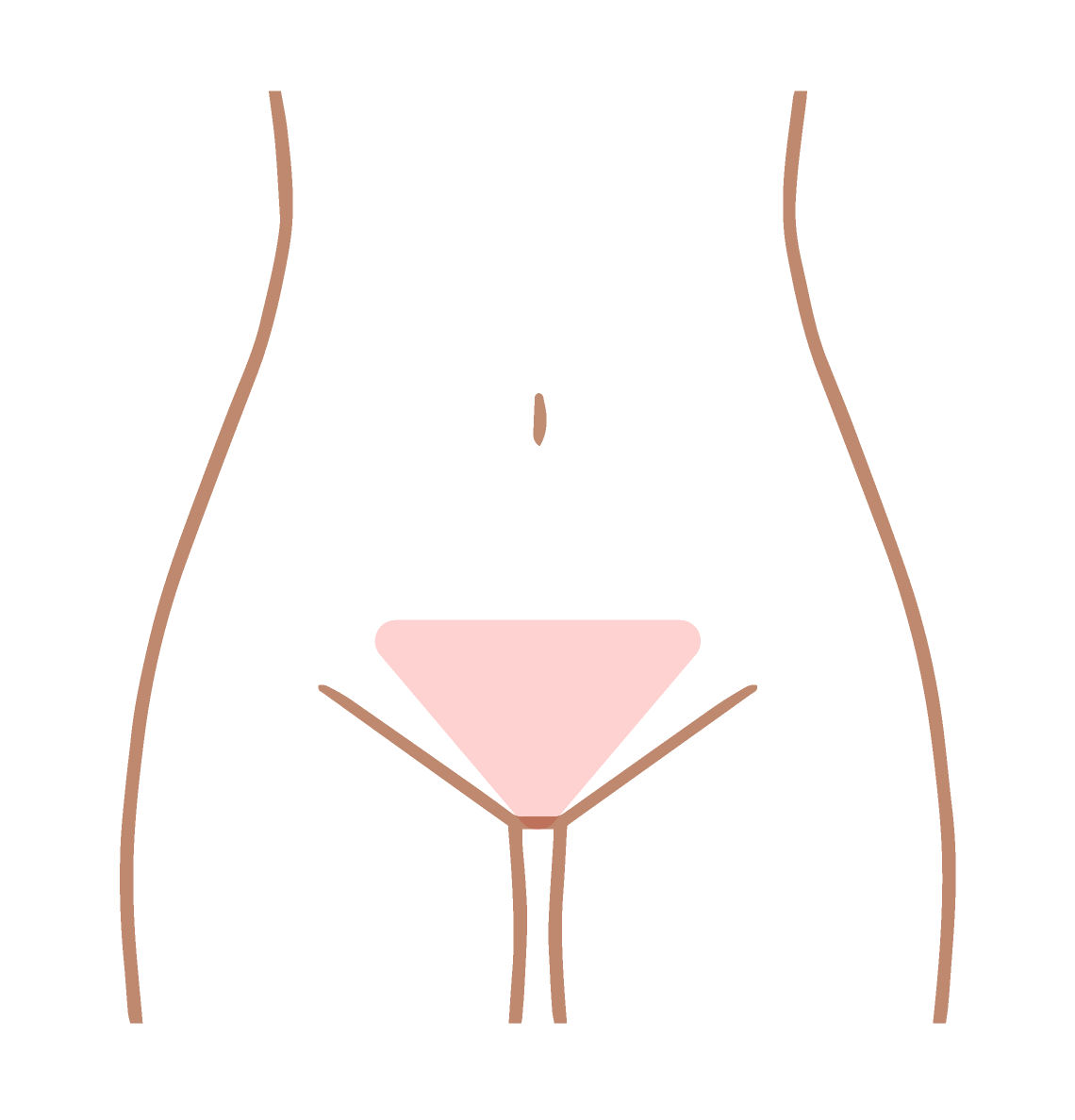 VIO脱毛