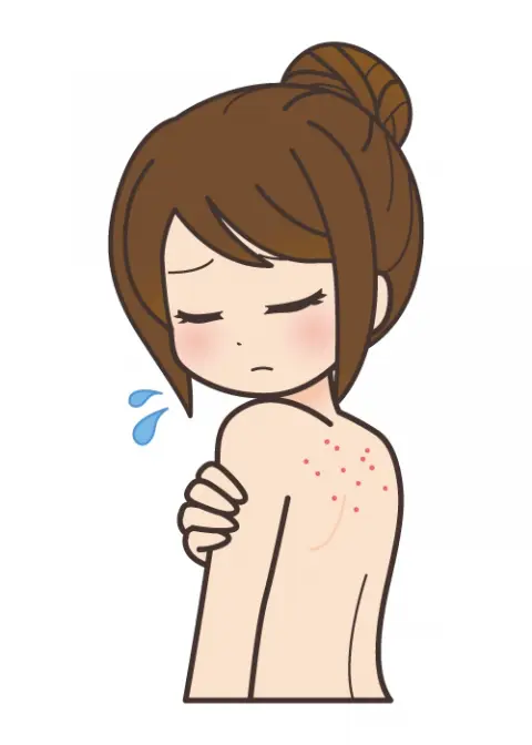 この時期体にできやすい【癜風】に注意！
